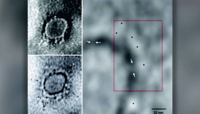 കൊറോണ വൈറസിന്റെ ആദ്യം ചിത്രം പുറത്തുവിട്ട് ഇന്ത്യന്‍ ശാസ്ത്രജ്ഞര്‍; മൈക്രോ സ്‌കോപിക് ചിത്രം തയ്യാറാക്കിയത് കേരളത്തിലെ രോഗിയില്‍ നിന്നും എടുത്ത സാമ്പിളിലൂടെ