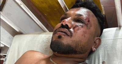 വിമാനദുരന്തം; വിമാനത്തിലുണ്ടായിരുന്നവരിൽ ഒരാൾ രക്ഷപ്പെട്ടതായി റിപ്പോർട്ട്