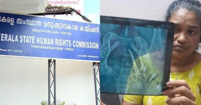 വീട്ടമ്മയുടെ വയറ്റില്‍ കത്രിക കുടുങ്ങിയ സംഭവം; സ്വമേധയാ കേസെടുത്ത് മനുഷ്യാവകാശ കമ്മീഷന്‍