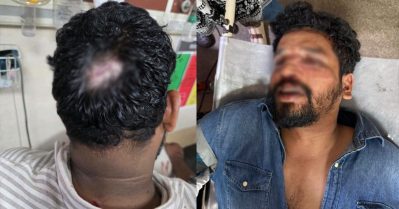 എസ്.എഫ്.ഐ നേതാക്കളെ ആക്രമിച്ച സംഭവം; എം.എസ്.എഫ് നേതാക്കള്‍ക്കെതിരെ വധശ്രമത്തിന് കേസെടുത്ത് പൊലീസ്