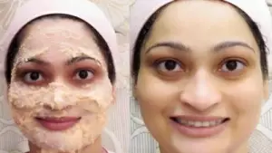 മഴക്കാലത്ത് മുഖം തിളങ്ങാന്‍ ഫേസ്പാക്കുകള്‍