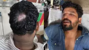 എസ്.എഫ്.ഐ നേതാക്കളെ ആക്രമിച്ച സംഭവം; എം.എസ്.എഫ് നേതാക്കള്‍ക്കെതിരെ വധശ്രമത്തിന് കേസെടുത്ത് പൊലീസ്