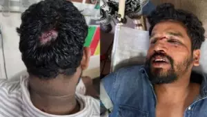 എസ്.എഫ്.ഐ നേതാക്കളെ ആക്രമിച്ച സംഭവം; എം.എസ്.എഫ് നേതാക്കള്‍ക്കെതിരെ വധശ്രമത്തിന് കേസെടുത്ത് പൊലീസ്