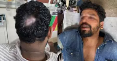 എസ്.എഫ്.ഐ നേതാക്കളെ ആക്രമിച്ച സംഭവം; എം.എസ്.എഫ് നേതാക്കള്‍ക്കെതിരെ വധശ്രമത്തിന് കേസെടുത്ത് പൊലീസ്