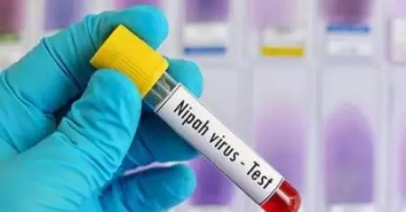 നിപയില്‍ ആശ്വാസം; പുതിയ കേസുകളില്ല