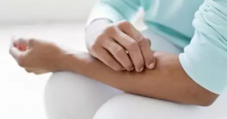 ഫം​ഗ​സി​നെ തു​ര​ത്താം