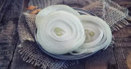 As Onion Price Soars, Brawl in Kerala for Not Serving Onion Slice with Beef; Restaurant Owner Booked
