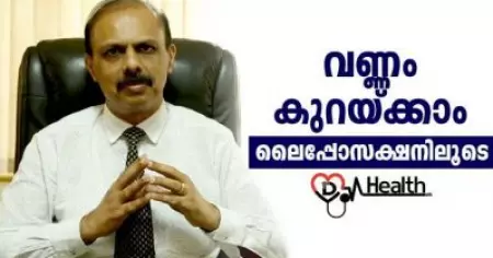 വണ്ണം കുറയ്ക്കാം ലൈപ്പോസക്ഷനിലൂടെ