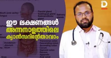 ഈ ലക്ഷണങ്ങള്‍ അന്നനാളത്തിലെ ക്യാന്‍സറിന്റേതാവാം