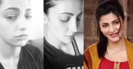 പ്ലാസ്റ്റിക് സര്‍ജറിക്ക് വിധേയയിട്ടുണ്ട്, അത് അംഗീകരിക്കുന്നതിന് നാണക്കേട് തോന്നുന്നില്ല; ഇത് എന്റെ ജീവിതമാണ് ; വിമര്‍ശകര്‍ക്ക് മറുപടിയുമായി ശ്രുതിഹാസന്‍
