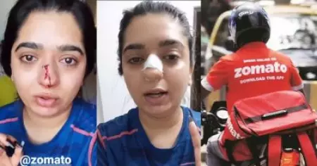ഓര്‍ഡര്‍ ചെയ്ത ഭക്ഷണം വൈകിയത് ചോദ്യം ചെയ്തതിന് സൊമാറ്റോ ഡെലിവറി ബോയ് ആക്രമിച്ചെന്ന് മേക്ക് അപ്പ് ആര്‍ട്ടിസ്റ്റ്