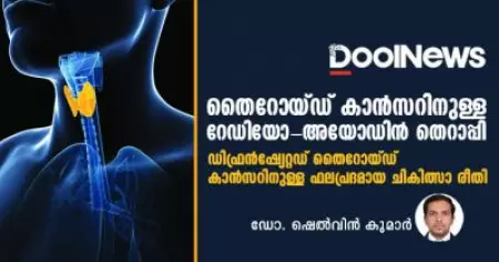 തൈറോയ്ഡ് കാന്‍സറിനുള്ള റേഡിയോ-അയോഡിന്‍ തെറാപ്പി: ഡിഫ്രന്‍ഷ്യേറ്റഡ് തൈറോയ്ഡ് കാന്‍സറിനുള്ള ഫലപ്രദമായ ചികിത്സാ രീതി