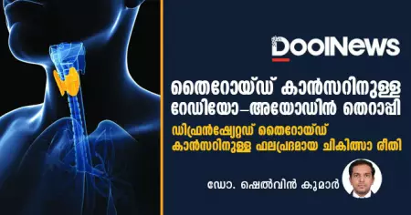 തൈറോയ്ഡ് കാന്‍സറിനുള്ള റേഡിയോ-അയോഡിന്‍ തെറാപ്പി: ഡിഫ്രന്‍ഷ്യേറ്റഡ് തൈറോയ്ഡ് കാന്‍സറിനുള്ള ഫലപ്രദമായ ചികിത്സാ രീതി