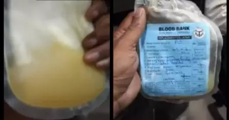 പ്ലാസ്മക്ക് പകരം മുസംബി ജ്യൂസ് നൽകി, രോ​ഗി മരിച്ചു; അന്വേഷണത്തിന് ഉത്തരവിട്ട് യു.പി സർക്കാർ