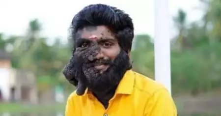അപൂര്‍വ രോഗത്തിനെതിരെ പോരാടിയ പ്രഭുലാല്‍ പ്രസന്നന്‍ വിടവാങ്ങി