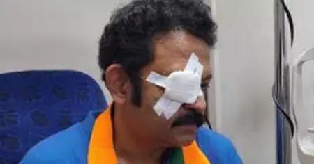 കൊല്ലത്തെ എൻ.ഡി.എ സ്ഥാനാർത്ഥിയുടെ കണ്ണിന് പരിക്കേറ്റ സംഭവം; ബി.ജെ.പി പ്രവർത്തകൻ അറസ്റ്റിൽ