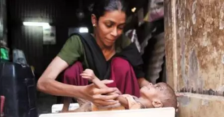 ഇന്ത്യയില്‍ അഞ്ച് വയസില്‍ താഴെയുള്ള 50 ശതമാനം കുട്ടികളില്‍ കടുത്ത പോഷകാഹാരക്കുറവെന്ന് ഡബ്ല്യു.സി.ഡി റിപ്പോര്‍ട്ട്