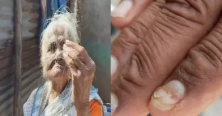 മുടിയ്ക്ക് പിന്നാലെ നഖങ്ങളും കൊഴിയുന്നു; ആശങ്കയിലായി മഹാരാഷ്ട്രയിലെ ഷെഗാവോണ്‍ ഗ്രാമവാസികള്‍