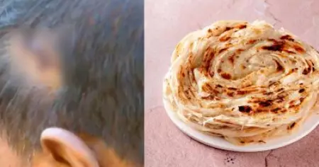 കൊല്ലത്ത് പൊറോട്ട കിട്ടാത്തതിന്റെ പേരില്‍ ഹോട്ടലുടമയുടെ തല അടിച്ച് പൊട്ടിച്ചു
