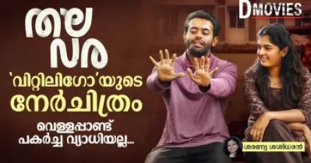 തലവര: വിറ്റിലിഗോയുടെ നേർചിത്രം; വെള്ളപ്പാണ്ട് പകർച്ച വ്യാധിയല്ല
