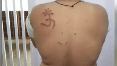 പഴുപ്പിച്ച ലോഹം കൊണ്ട് ശരീരത്തില്‍ ‘ഓം’ വരച്ചു; തിഹാര്‍ ജയിലില്‍ മുസ്‌ലിം തടവുകാരന് ക്രൂര പീഡനം