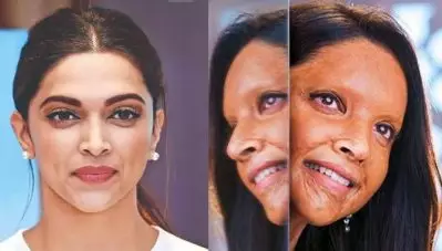 ‘ചപക്’ ഇതു വരെ ചെയ്തതില്‍ ഏറ്റവും ബുദ്ധിമുട്ടേറിയ സിനിമ, കഥാപാത്രത്തില്‍ നിന്നും വിട്ടു പോകാന്‍ ബുദ്ധിമുട്ടി-ദീപിക പദുകോണ്‍
