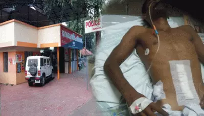 യുവാവിനെ കുണ്ടറ പൊലീസ് മര്‍ദ്ദിച്ച സംഭവം; കുടല്‍ മുറിഞ്ഞ യുവാവ് സംസാരിക്കാന്‍ പോലും കഴിയാത്ത അവസ്ഥയിലെന്ന് വക്കീല്‍; കേസെടുത്തതിലും പാളിച്ച