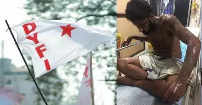 ഡി.വൈ.എഫ്.ഐ നേതാവിനെതിരെ ആസിഡ് ആക്രമണം; ഗുരുതര പരിക്ക്