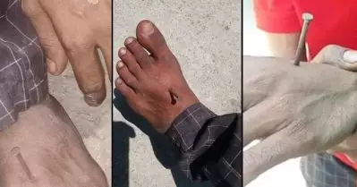 യു.പിയില്‍ മാസ്‌ക് ധരിച്ചില്ലെന്നാരോപിച്ച് യുവാവിന്റെ കാലില്‍ പൊലീസ് ആണി തറച്ചുകയറ്റിയെന്ന് ആരോപണം; നിഷേധിച്ച് പൊലീസുദ്യോഗസ്ഥര്‍