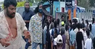 കപ്പലണ്ടിയ്ക്ക് എരിവില്ലാത്തതിനാല്‍ കൂട്ടത്തല്ല്; നിരവധി പേര്‍ക്ക് പരിക്ക്