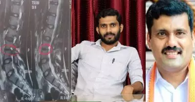 ‘ചാനല്‍ ചര്‍ച്ചകളില്‍ മലാഖ ചമയുന്ന റിജില്‍ മാക്കുറ്റി കെ.എസ്. ബ്രിഗേഡിലെ ഗുണ്ട, അദ്ദേഹവും കൂട്ടരും തകര്‍ത്ത എന്റെ നട്ടെല്ലാണിത്’; തുറന്നുകാട്ടി മുന്‍ എസ്.എഫ്.ഐ നേതാവ്