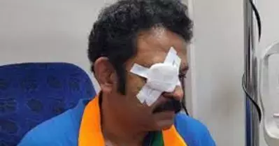 കൊല്ലത്തെ എൻ.ഡി.എ സ്ഥാനാർത്ഥിയുടെ കണ്ണിന് പരിക്കേറ്റ സംഭവം; ബി.ജെ.പി പ്രവർത്തകൻ അറസ്റ്റിൽ