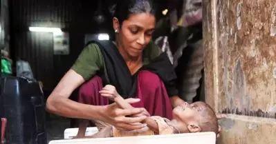 ഇന്ത്യയില്‍ അഞ്ച് വയസില്‍ താഴെയുള്ള 50 ശതമാനം കുട്ടികളില്‍ കടുത്ത പോഷകാഹാരക്കുറവെന്ന് ഡബ്ല്യു.സി.ഡി റിപ്പോര്‍ട്ട്