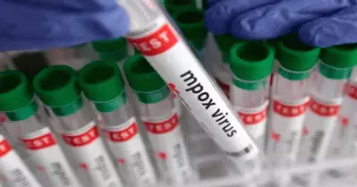 മലപ്പുറത്ത് എം പോക്‌സ് സ്ഥിരീകരിച്ചു