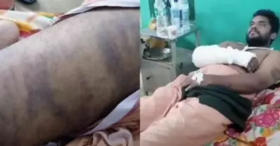 ആറ്റിങ്ങലില്‍ യുവാവിനെ പൊലീസ് മര്‍ദിച്ചതായി പരാതി