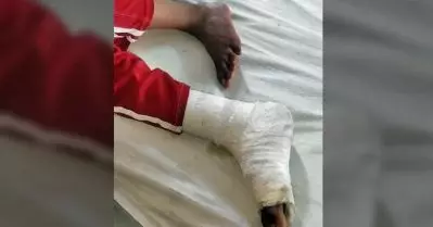 ഉത്തർപ്രദേശിൽ അധ്യാപകൻ വിദ്യാർത്ഥിയുടെ കാൽ തല്ലിയൊടിച്ചു, ജാതീയമായി അധിക്ഷേപിച്ചു