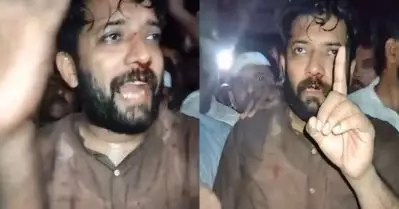 പൊലീസ് ലാത്തിച്ചാര്‍ജില്‍ ഷാഫി പറമ്പിലിന്റെ മുഖത്ത് പരിക്ക്; കോഴിക്കോട്ട് കോണ്‍ഗ്രസ് പ്രതിഷേധം