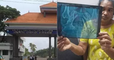 ആലപ്പുഴയില്‍ വീട്ടമ്മയുടെ വയറ്റില്‍ കത്രിക കുടുങ്ങിയതായി പരാതി; ആരോപണം വണ്ടാനം മെഡിക്കല്‍ കോളേജിനെതിരെ